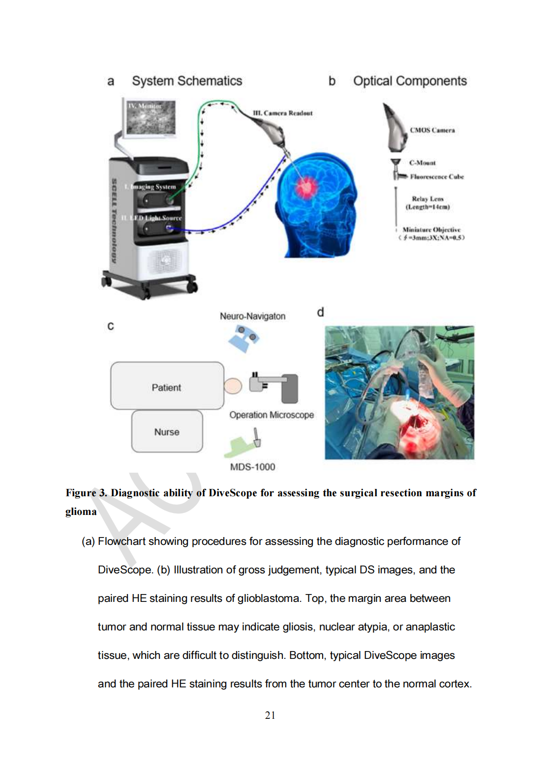 Roving histological imaging for navigation-confirmed glioma negative margin by handheld endomicroscopy: a parallel controlled study(圖21)