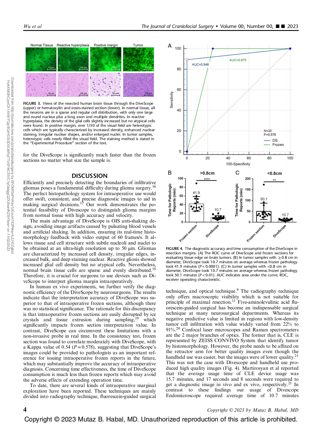 Application of a Novel Miniaturized Histopathologic Microscope for Ex Vivo Identifying Cerebral Glioma Margins Rapidly During Surgery: A Parallel Control Study(圖4)