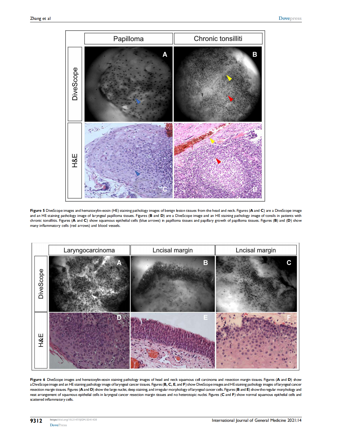 A Novel Cell Morphology Analyzer Application in  Head and Neck Cancer(圖6)