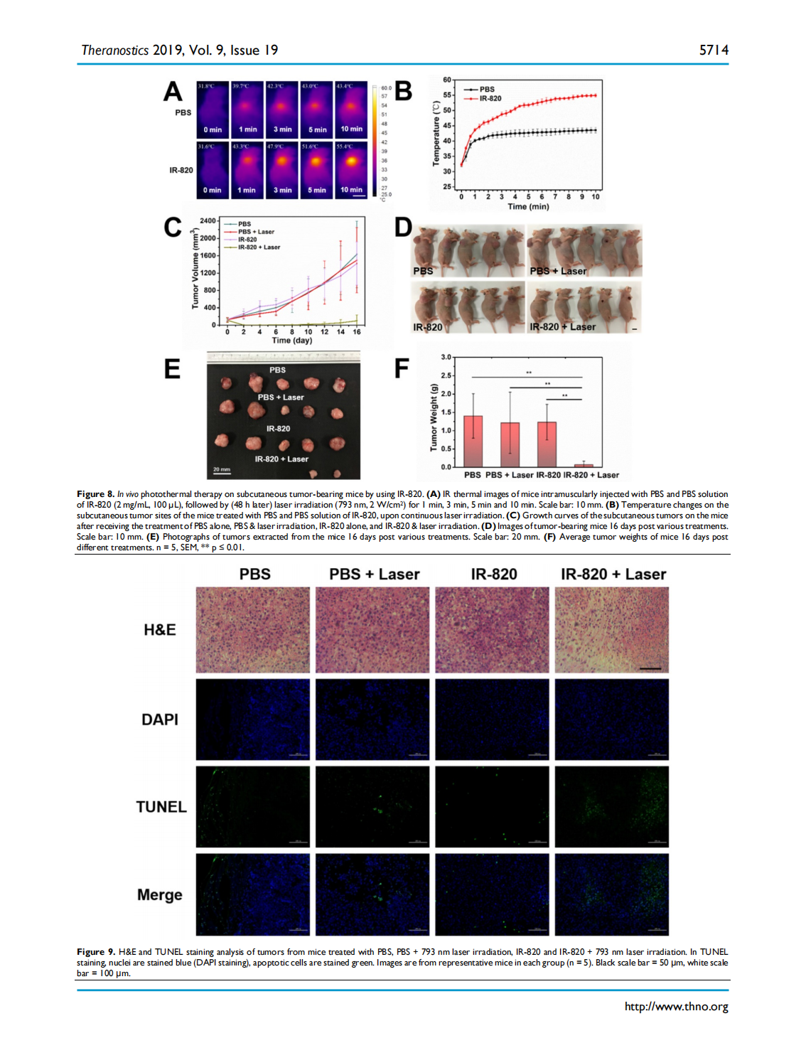 Excretable IR-820 for in vivo NIR-II fluorescence cerebrovascular imaging and photothermal therapy of subcutaneous tumor(圖9)