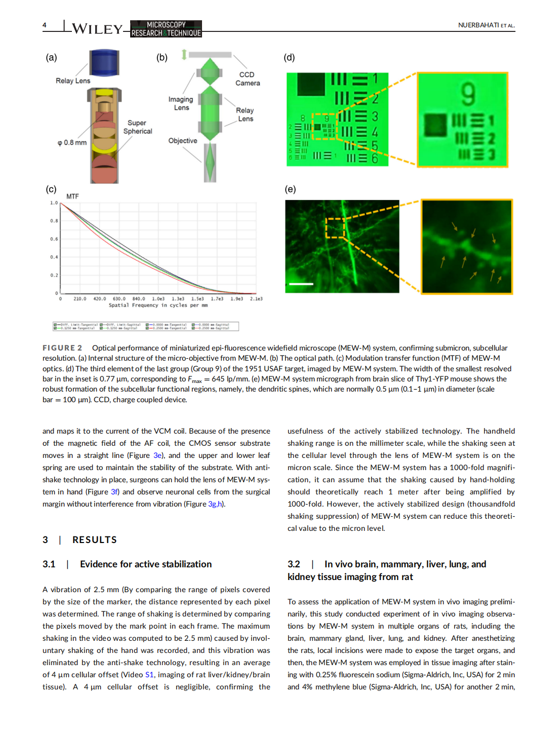 An actively stabilized, miniaturized epi-fluorescence widefield microscope for real-time observation in vivo(圖4)