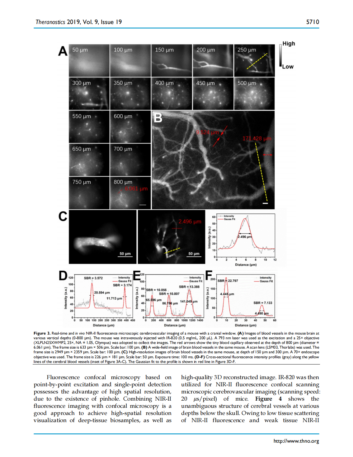 Excretable IR-820 for in vivo NIR-II fluorescence cerebrovascular imaging and photothermal therapy of subcutaneous tumor(圖5)