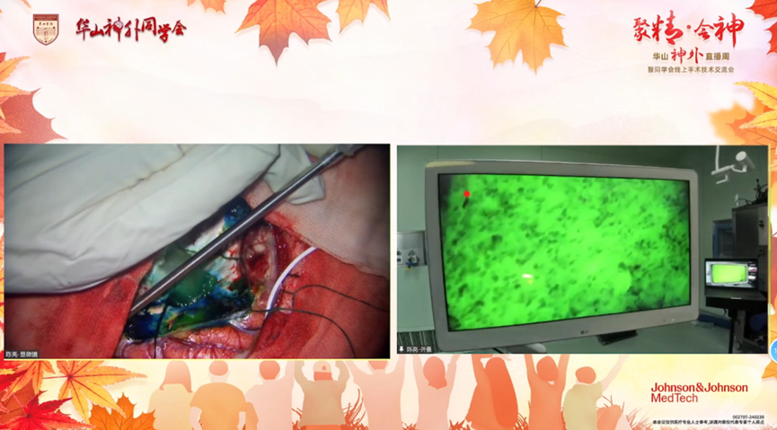 神經(jīng)系統(tǒng)非腫瘤性疾病(圖1)