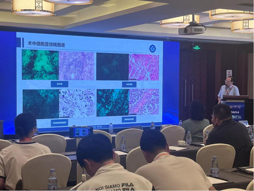 “細(xì)胞眼”助力精準(zhǔn)手術(shù):術(shù)中手持顯微鏡EndoSCell?成2024年人腦論壇亮點(diǎn)(圖5)