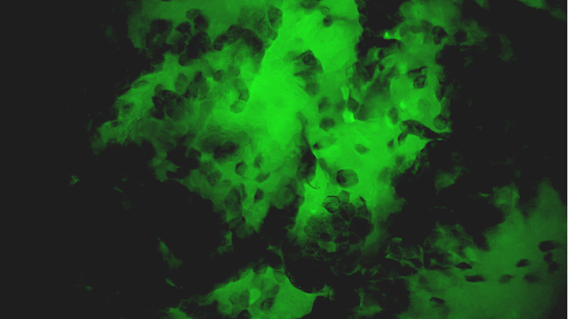 甲狀腺癌細(xì)胞級(jí)精準(zhǔn)手術(shù)即將實(shí)現(xiàn)！河北省人民醫(yī)院引入細(xì)胞級(jí)熒光導(dǎo)引技術(shù)(圖3)