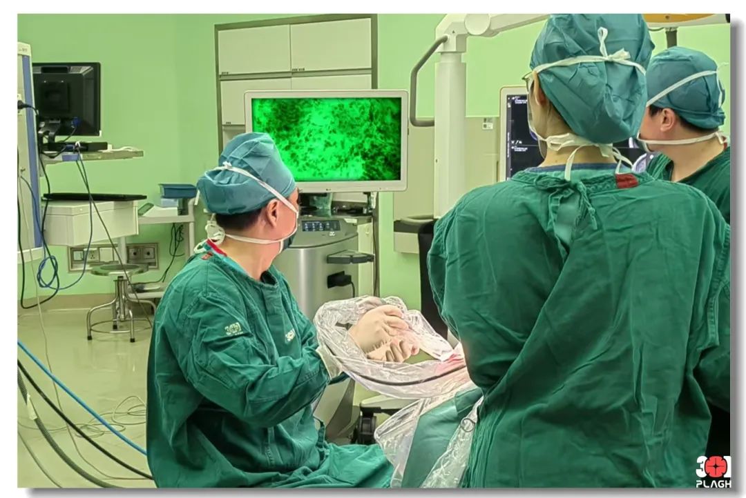 解放軍總醫(yī)院第一醫(yī)學中心神經(jīng)外科醫(yī)學部成功應用EndoSCell?精準切除腦膠質(zhì)瘤(圖5)