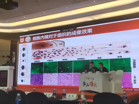 第三屆“華山峰彩”學(xué)術(shù)論壇盛大召開(kāi):專(zhuān)家共話(huà)細(xì)胞內(nèi)鏡EndoSCell?細(xì)胞級(jí)精準(zhǔn)手術(shù)方案(圖3)