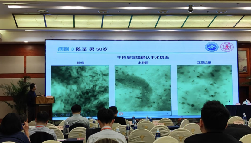 昆明神經(jīng)腫瘤論壇：EndoSCell?細(xì)胞級熒光導(dǎo)引技術(shù)開啟精準(zhǔn)手術(shù)新時(shí)代(圖5)