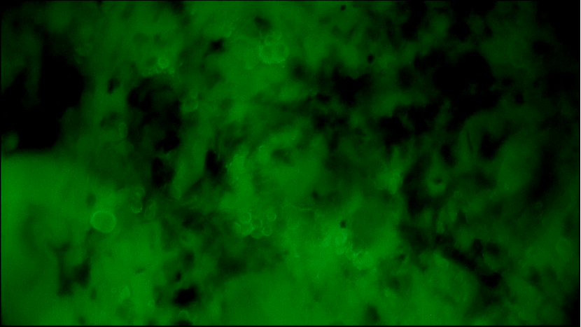 EndoSCell?助力邢臺市人民醫(yī)院成功完成首例乳腺腫瘤細(xì)胞級精準(zhǔn)切除手術(shù)(圖3)