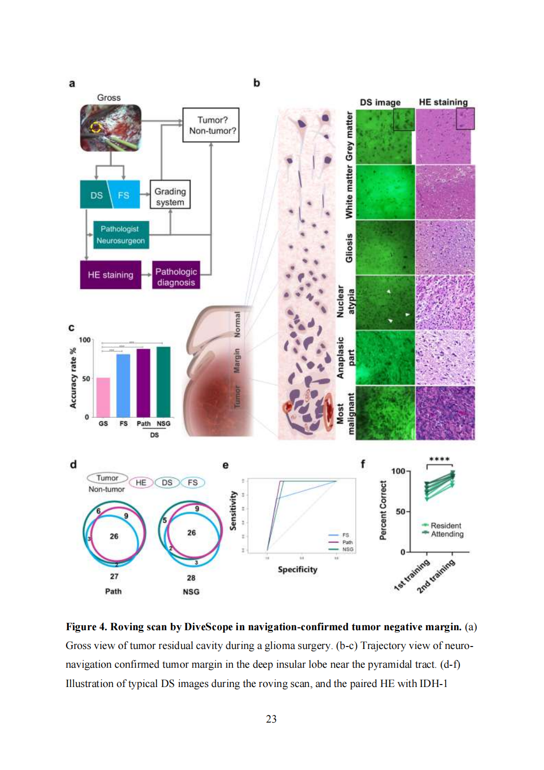 Roving histological imaging for navigation-confirmed glioma negative margin by handheld endomicroscopy: a parallel controlled study(圖23)