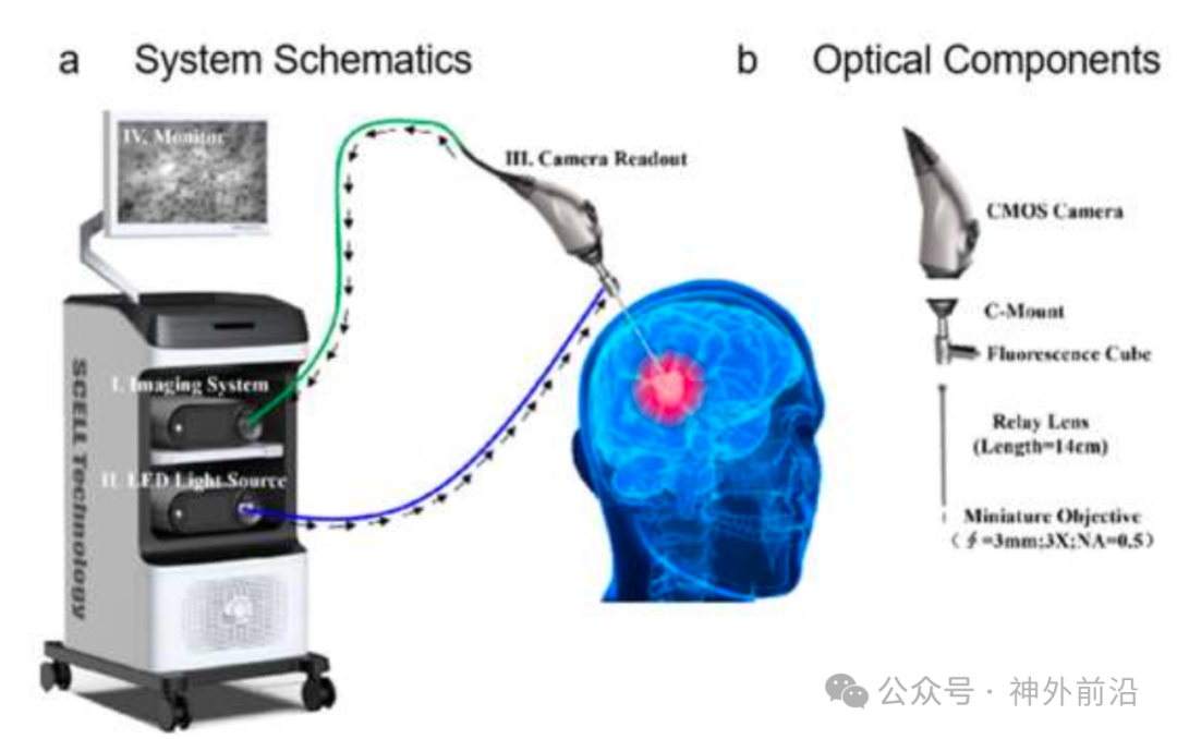 學(xué)術(shù)動(dòng)態(tài) | 華山神外團(tuán)隊(duì)報(bào)道膠質(zhì)瘤術(shù)中應(yīng)用手持病理顯微鏡輔助 可更精準(zhǔn)識(shí)別切除邊緣(圖2)