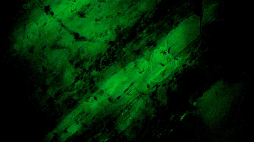 甲狀腺癌手術(shù)新突破！河北省人民醫(yī)院成功應(yīng)用細(xì)胞級熒光導(dǎo)引技術(shù)實(shí)現(xiàn)精準(zhǔn)切除與保功能(圖4)