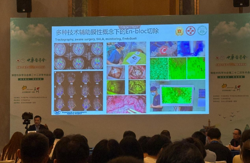 中華醫(yī)學(xué)會(huì)神經(jīng)外科學(xué)分會(huì)第二十二次學(xué)術(shù)會(huì)議在蘇召開(kāi):細(xì)胞級(jí)熒光導(dǎo)引技術(shù)引領(lǐng)神經(jīng)外科手術(shù)邁入精準(zhǔn)可視化新時(shí)代(圖9)